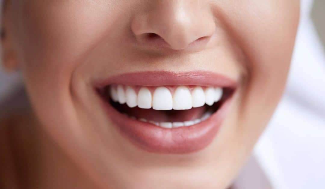 Is Teeth Whitening Bad?