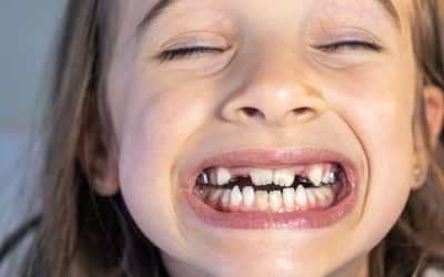 Loose Adult Tooth: Causes, Risks and Treatment