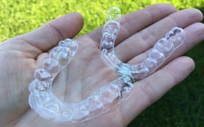 Clear Aligners: A Discreet Path to Straighter Teeth