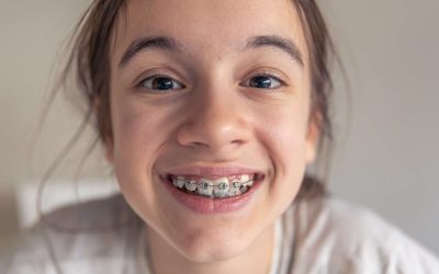 Do I Really Need Braces? How to Spot the Signs and When to See an Orthodontist 