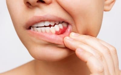 Gum Recession: Causes, Symptoms and Treatment