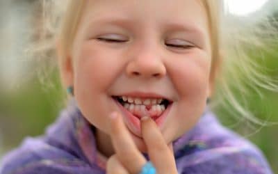 Knocked-Out Tooth: Emergency First Aid and Treatment at Albany Creek Dental